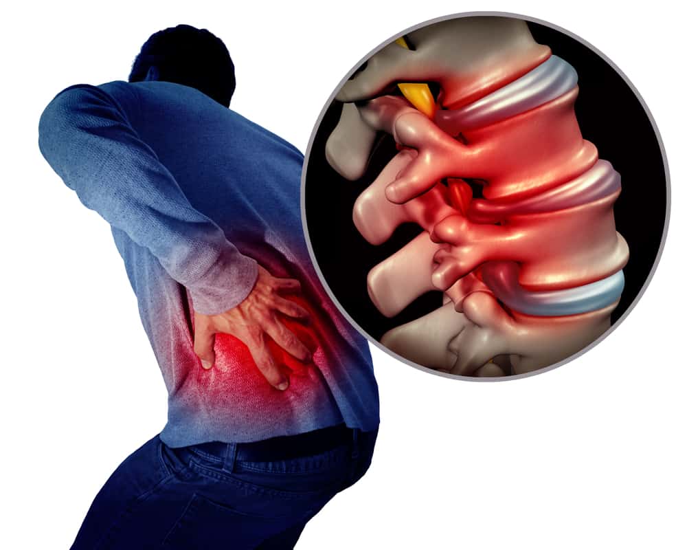 vitamins-and-food-help-sciatica
