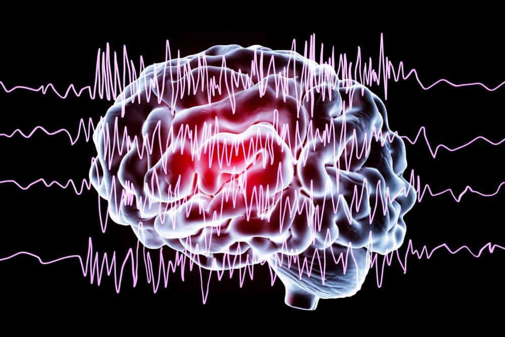 epilepsy