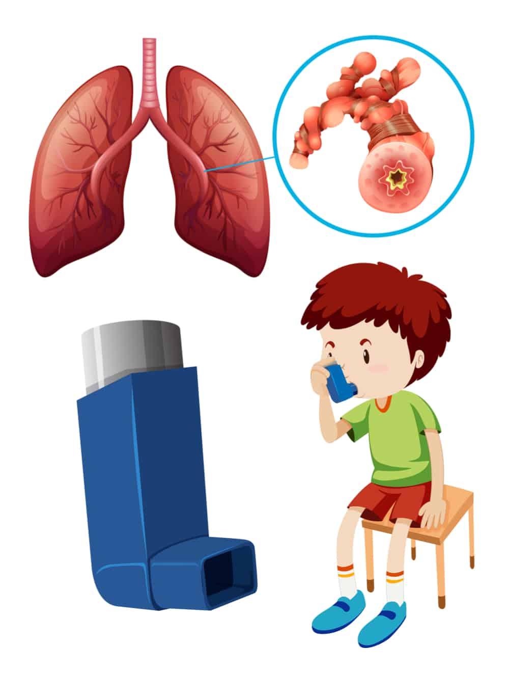 8-questions-to-ask-doctors-about-asthma