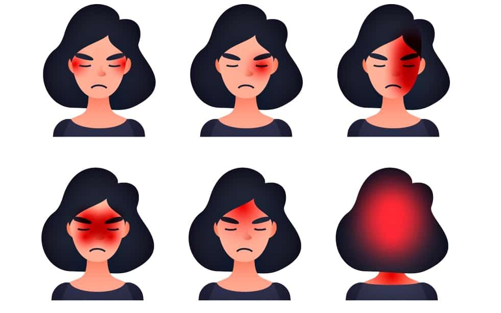 cluster-headache