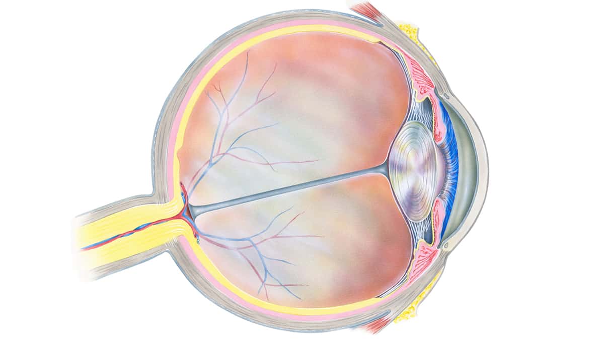 wet-macular-degeneration
