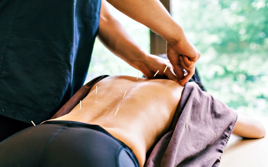 3-things-to-know-about-acupuncture-treatment-for-sciatica