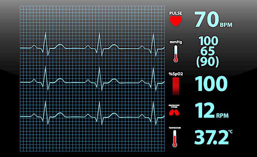 heart-monitor-to-prevent-stroke