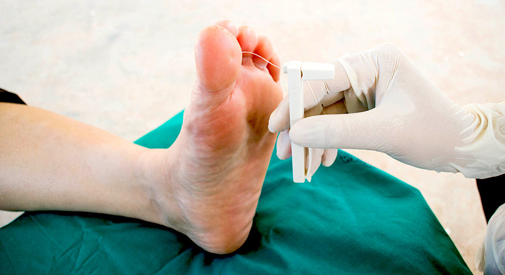 diabetes-complications-and-diabetic-neuropathy