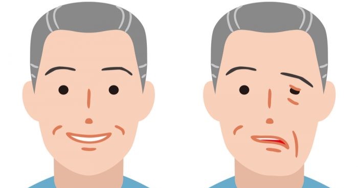 stroke-sequela-affects-health