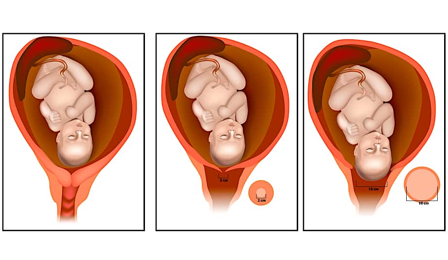 crowning-and-whole-process-of-childbirth