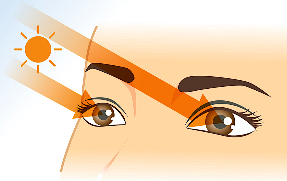 eye-burns-prevention-symptom