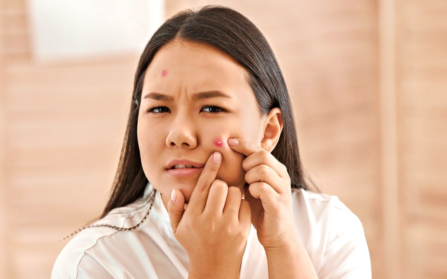 things-that-increase-your-risk-of-acne