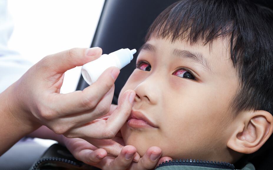 how-to-manage-your-pinkeye