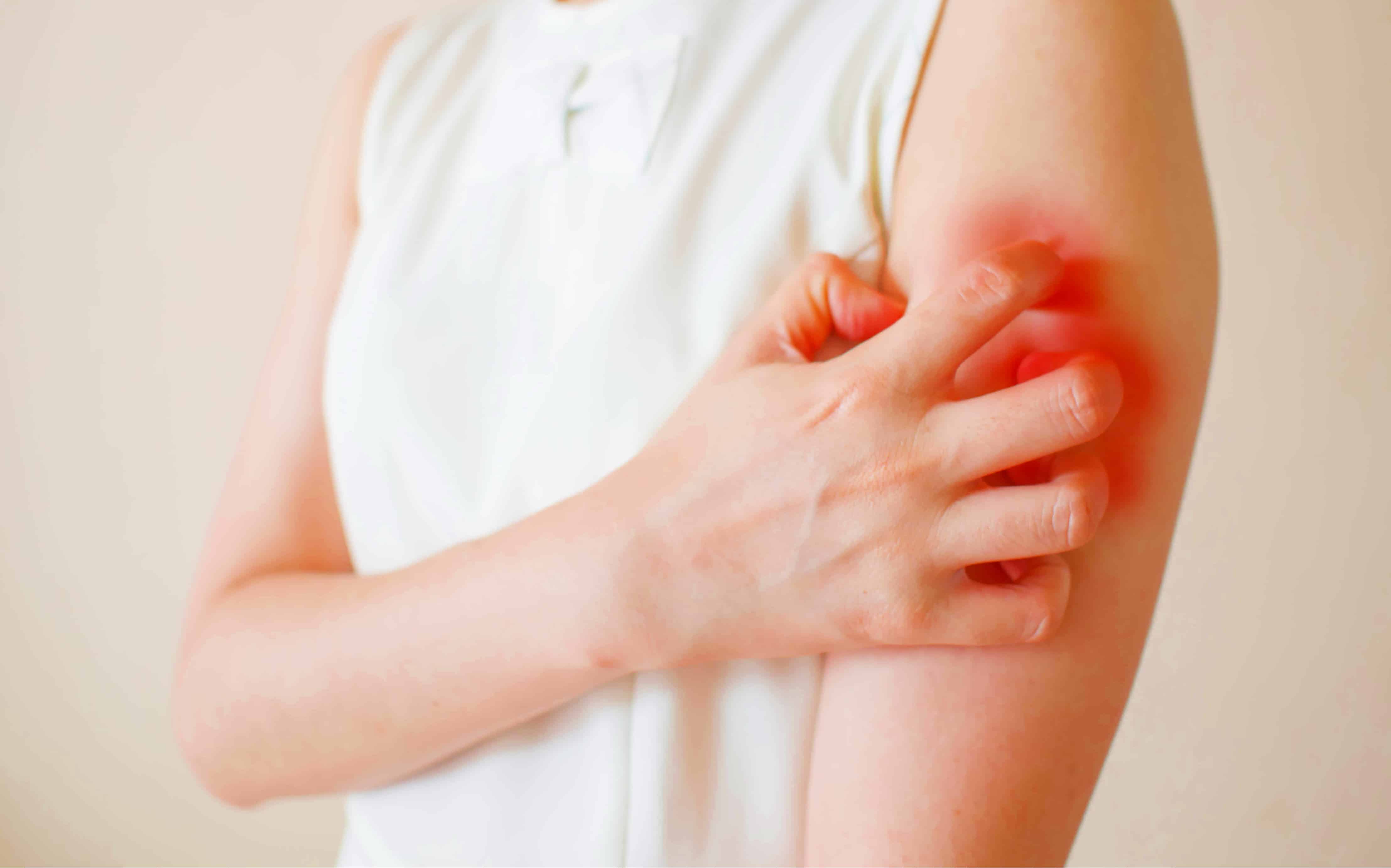 identify-and-care-for-an-amoxicillin-rash