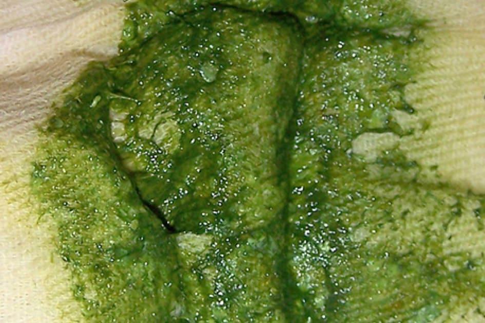 亮綠色