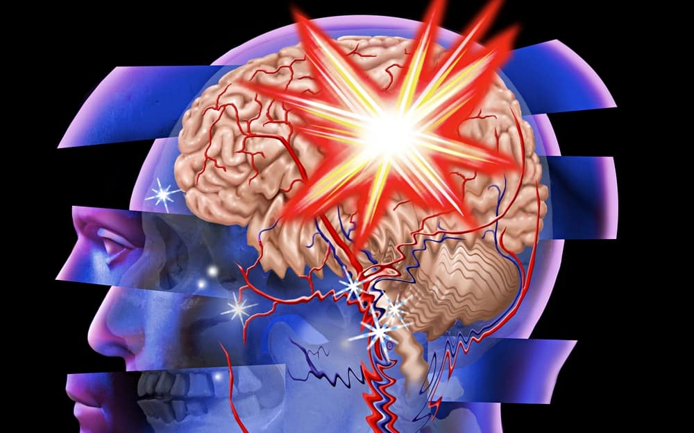 traumatic-brain-injury