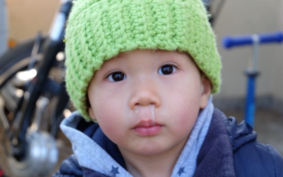 common-cold-in-babies
