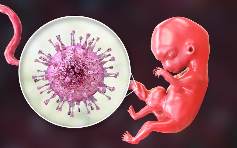 cytomegalovirus
