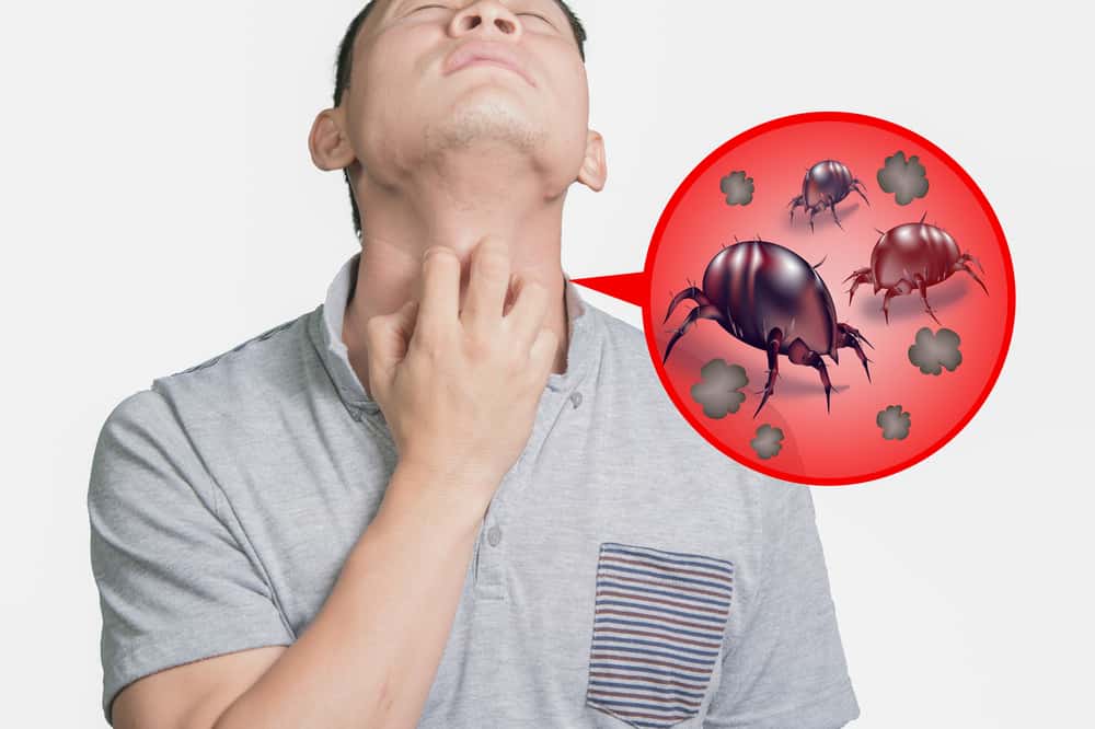 dust-mite-allergy
