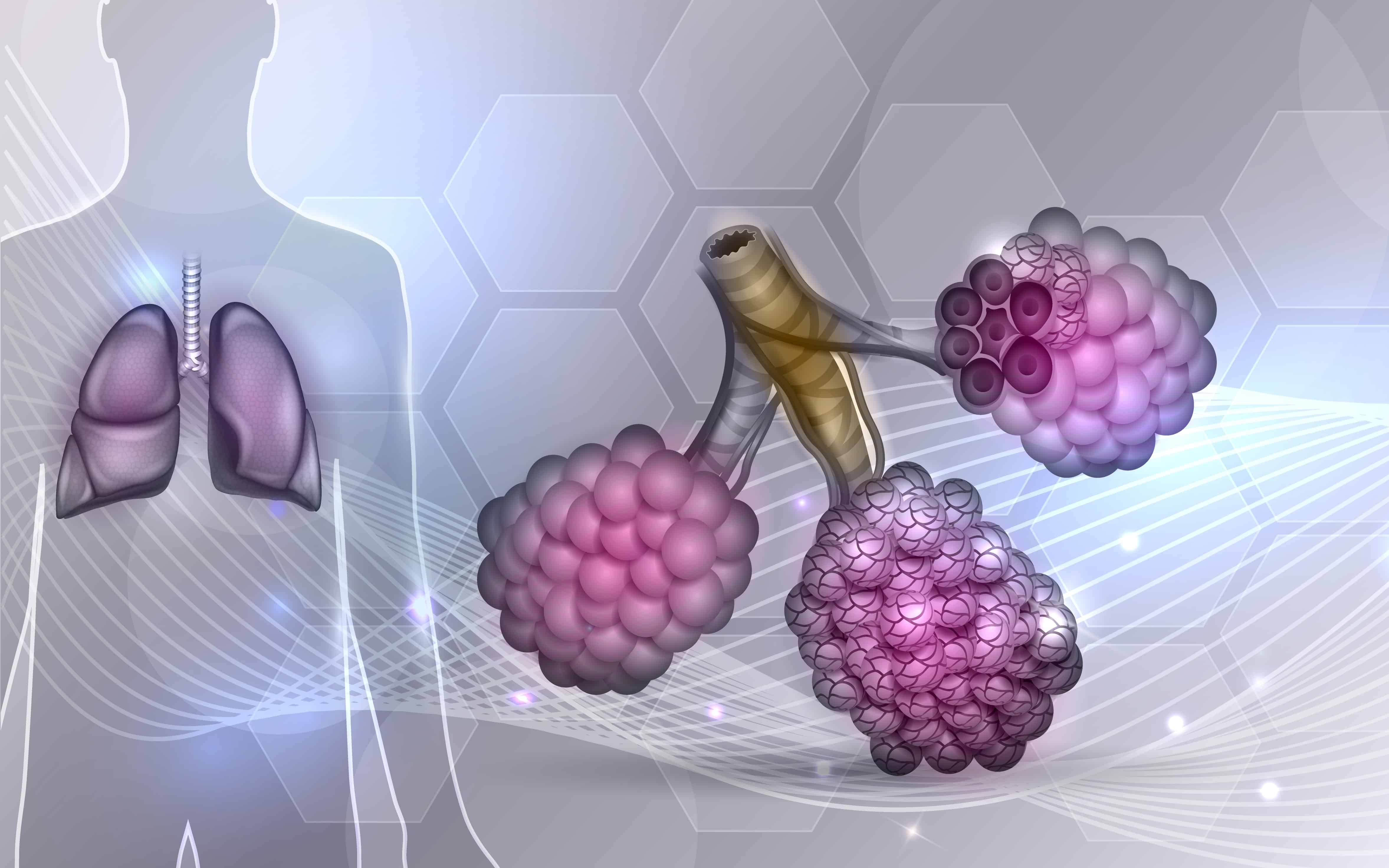 cystic-fibrosis