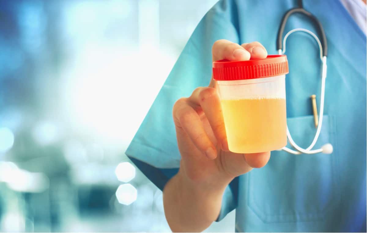 diabetes-check-up-test-test-for-ketones