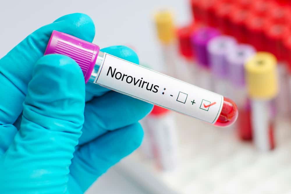 norovirus-causes-and-symptoms