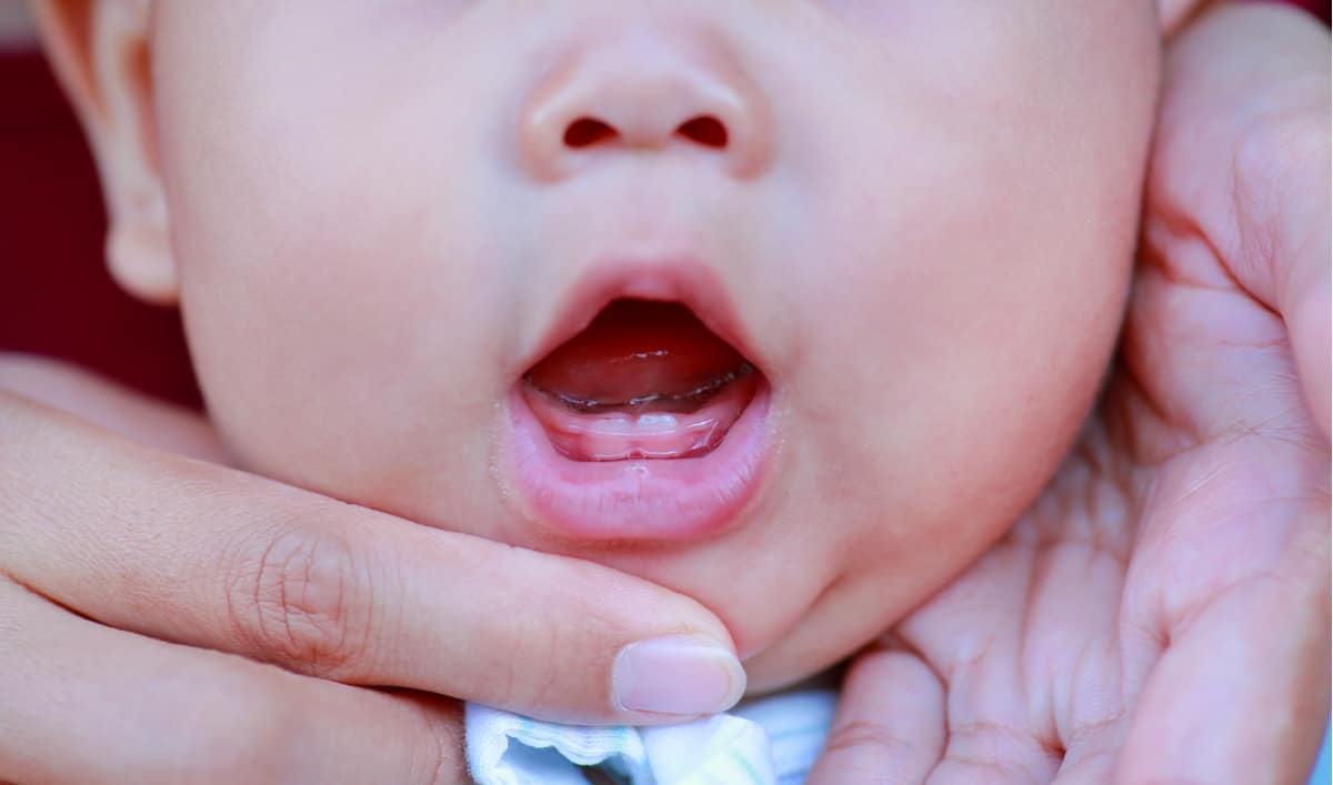 baby-teething-symptoms-and-treatment