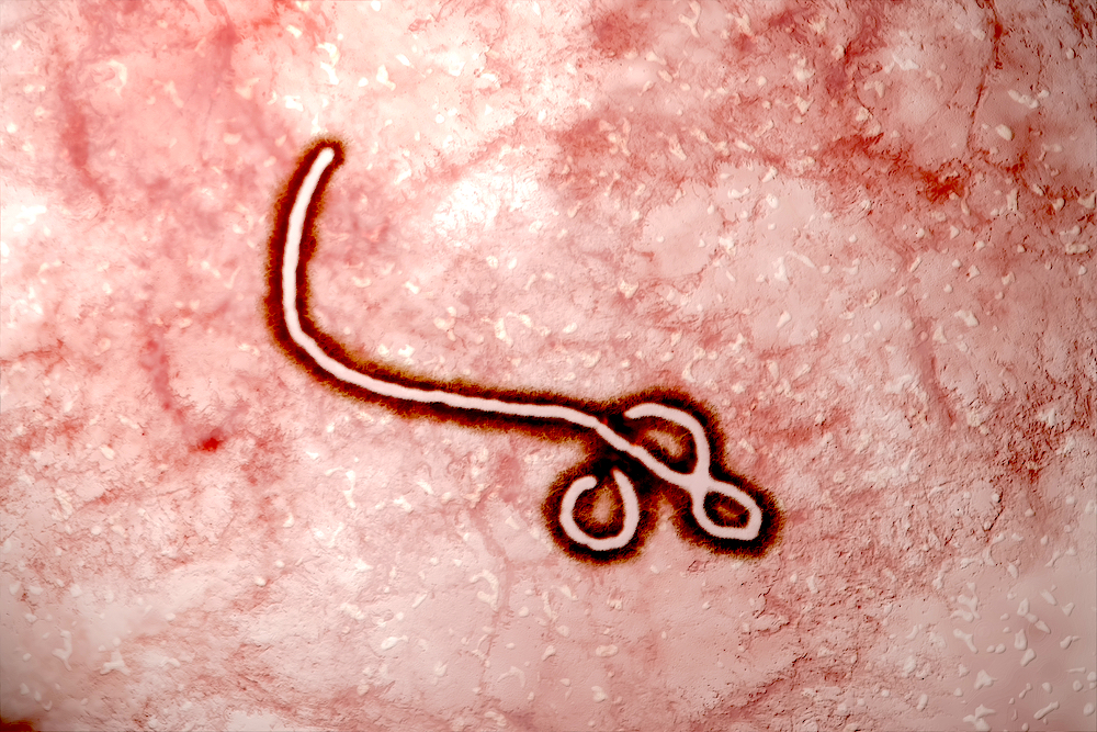 five-must-know-facts-of-ebola-virus