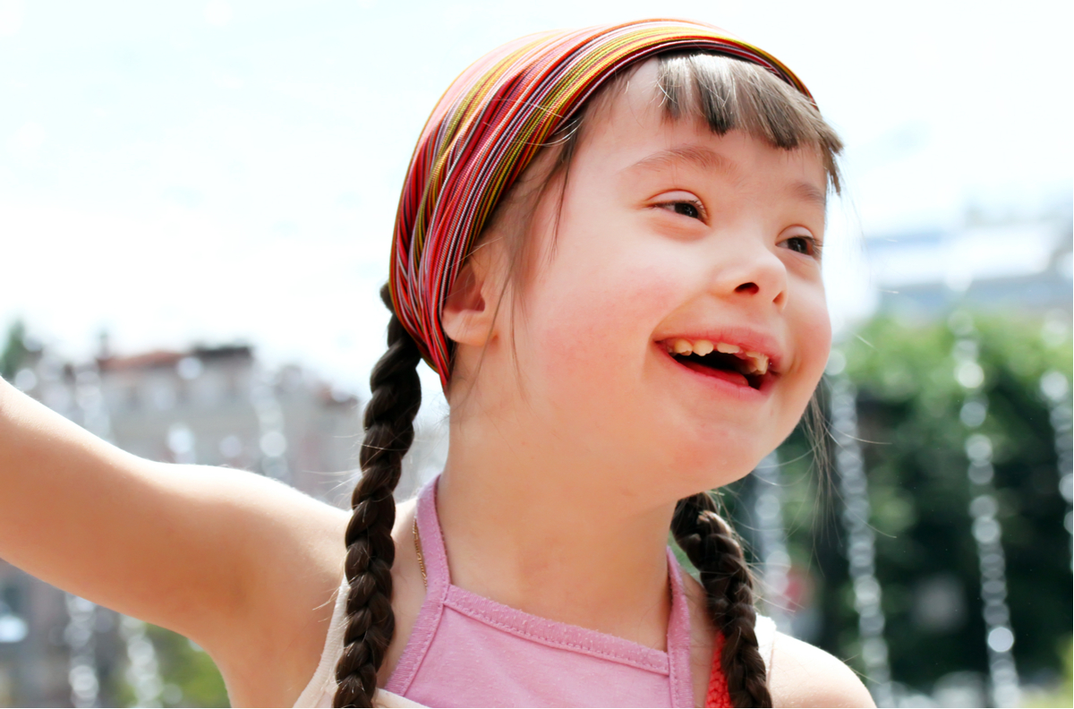 down-syndrome
