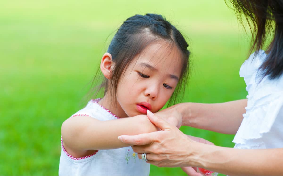 common-injuries-in-kids