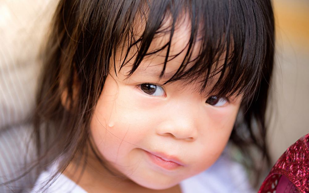 3-excessive-sweat-causes-in-kids
