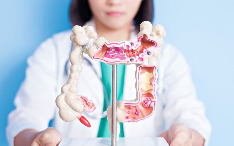 what-you-need-to-know-about-colon-cancer-in-pregnancy