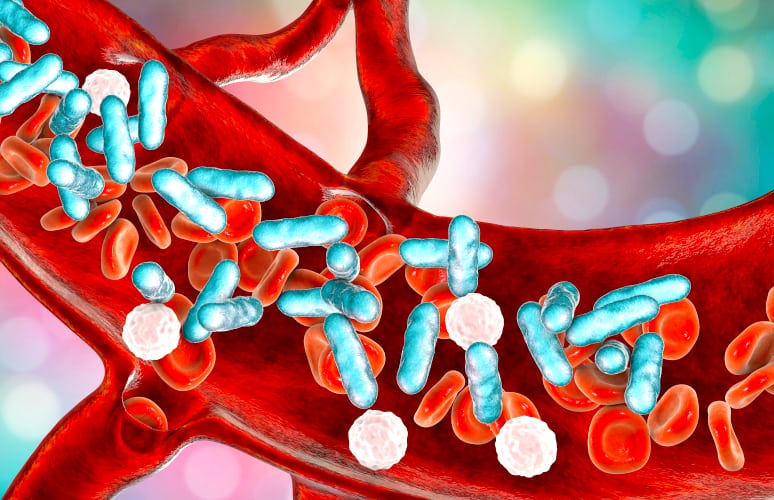 what-you-need-to-know-about-sepsis