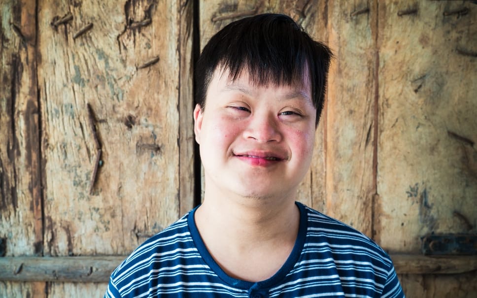 down-syndrome-in-newborns