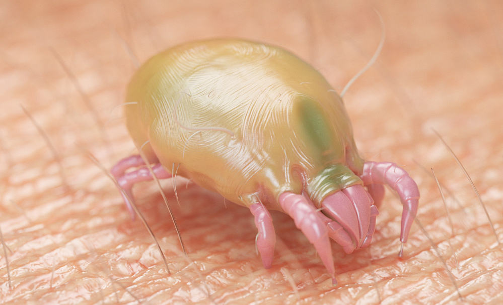 what-is-scabies-and-how-to-deal-with-it