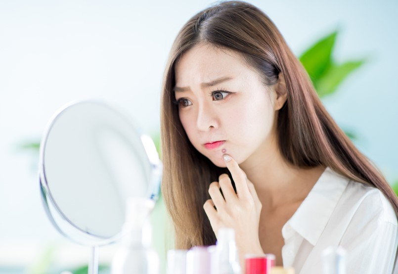 must-know-facts-about-acne