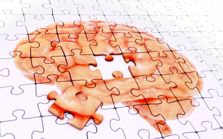 how-to-prevent-alzheimers-disease