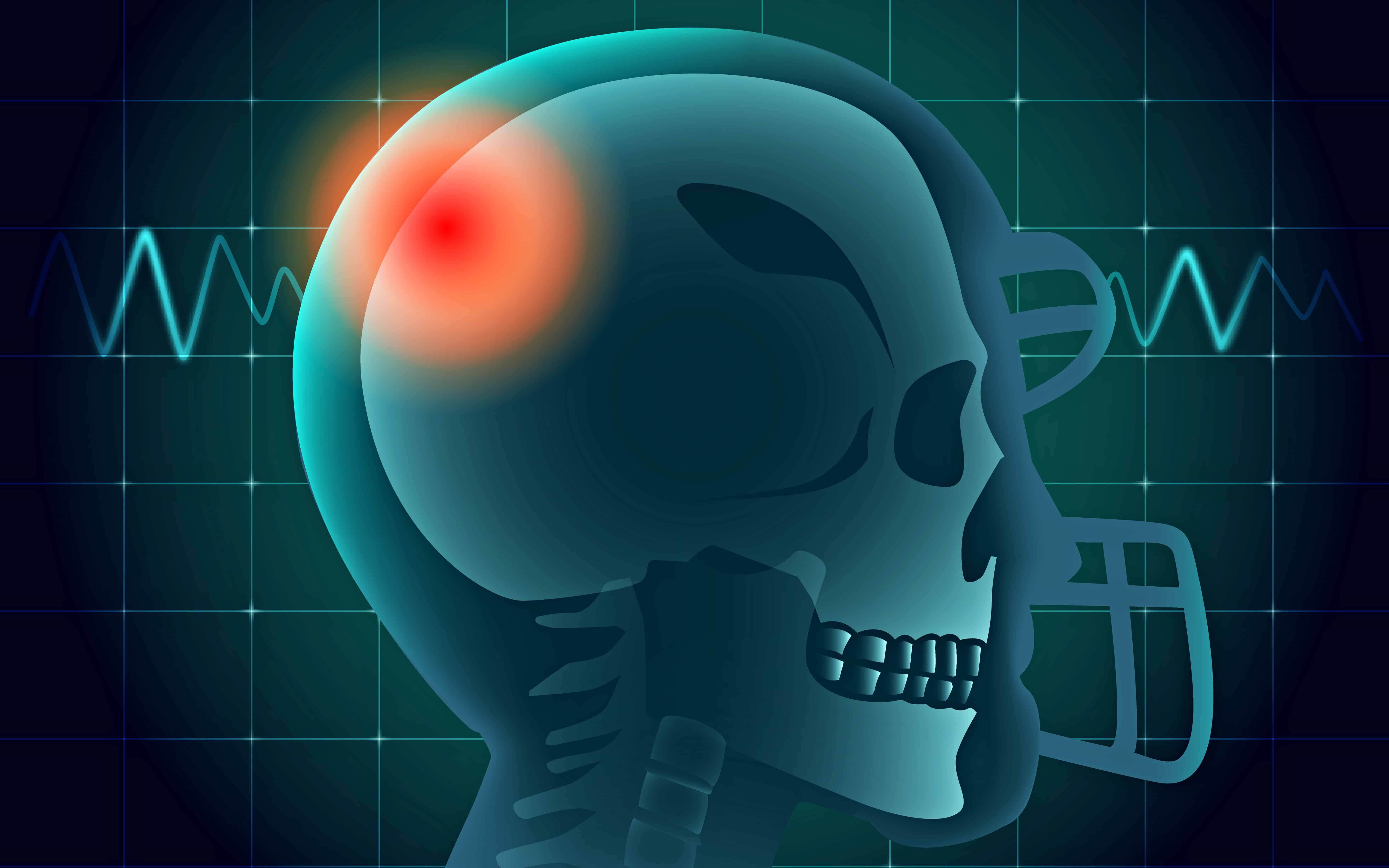 head-injury
