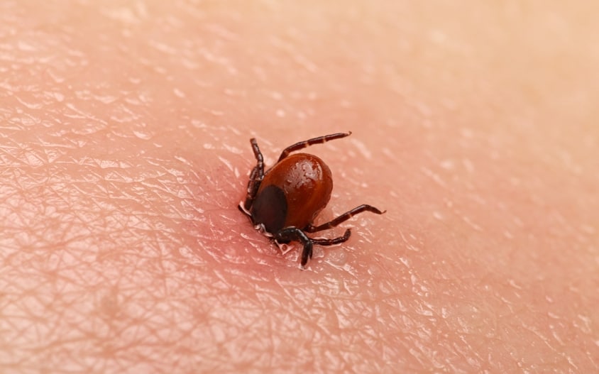 tick-bit-can-trigger-allergy-and-transmit-disease
