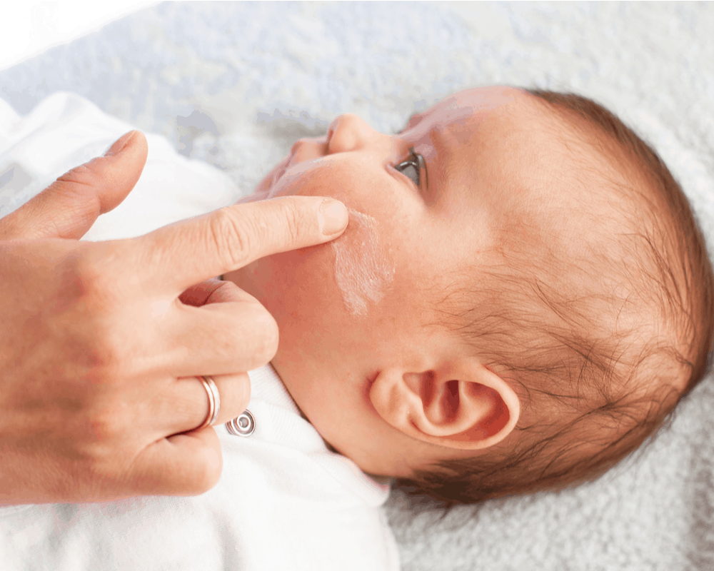 baby-eczema-reasons-symptoms-and-treatment