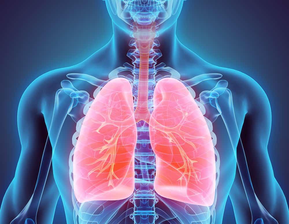 fungal-pneumonia