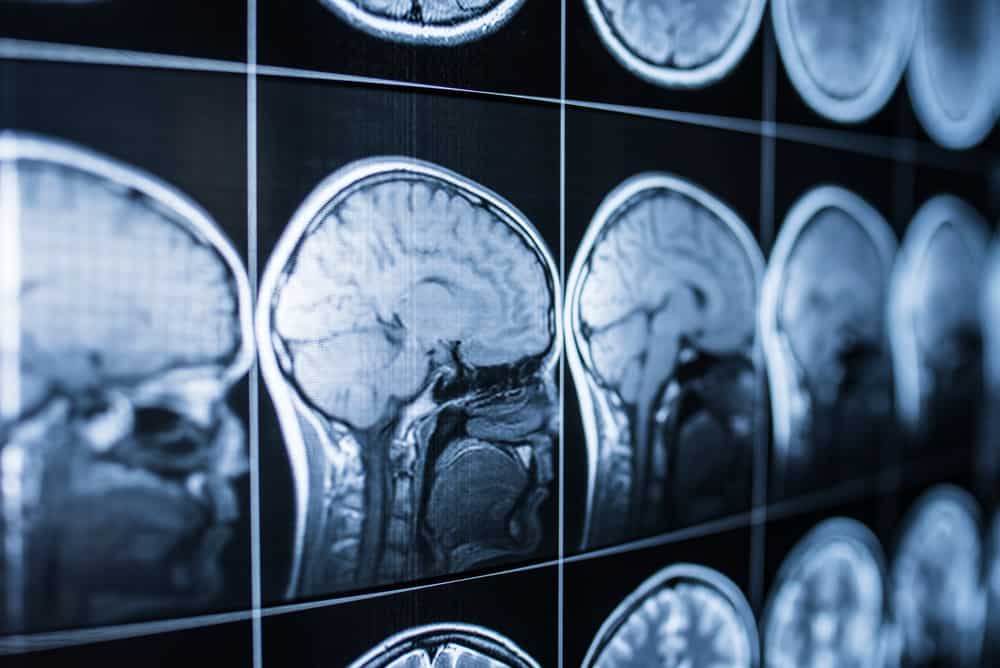 10-percent-of-the-brain-myth-buster