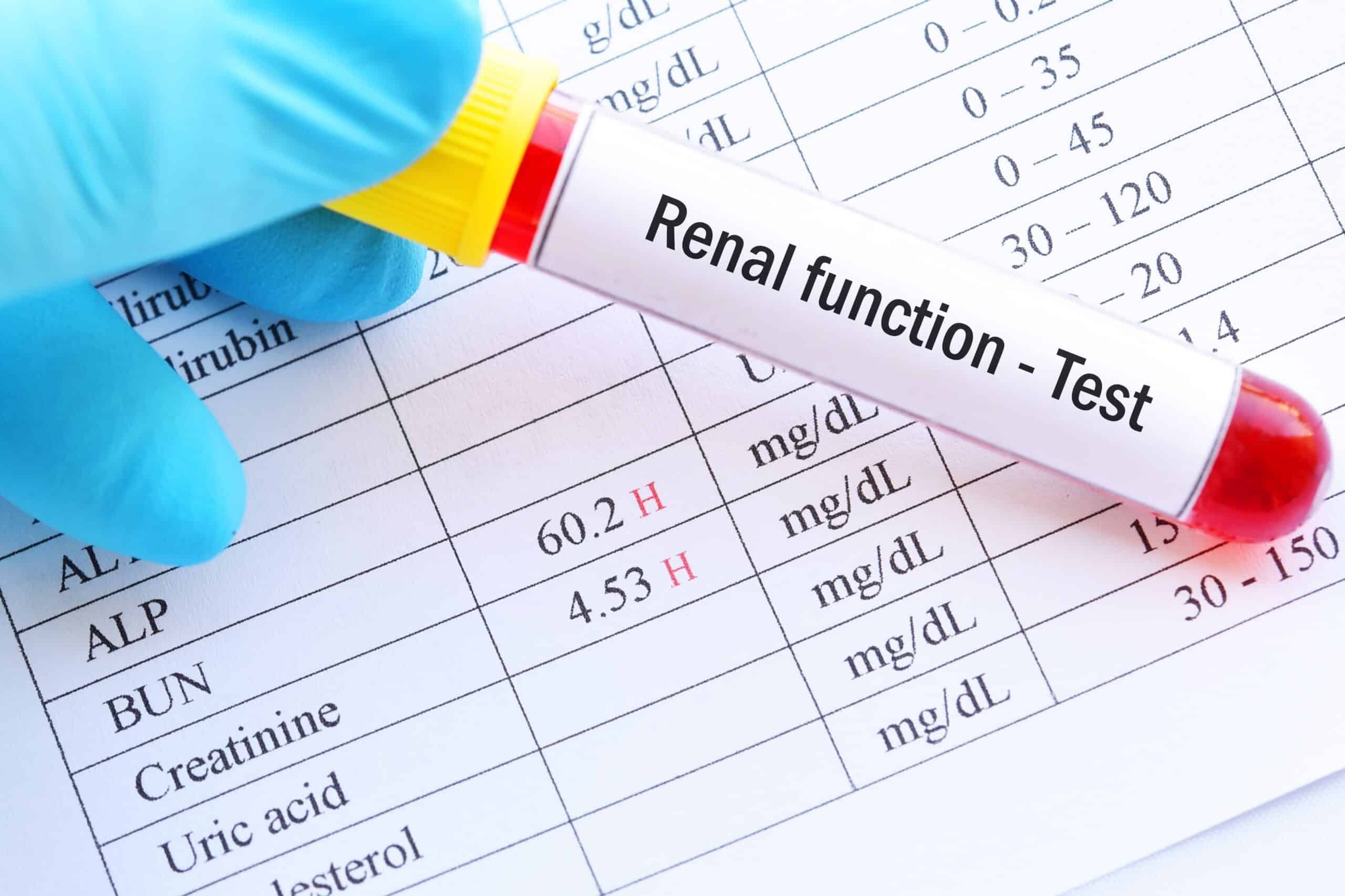 how-to-know-renal-function