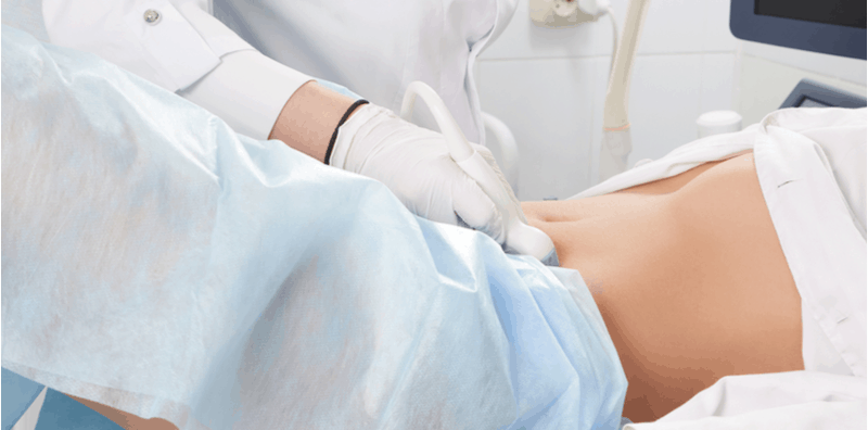 what-is-endometriosis