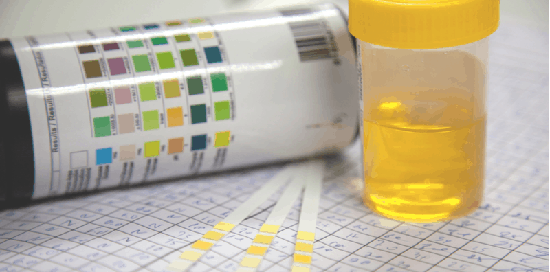 proteinuria-and-urine-protein-symptoms
