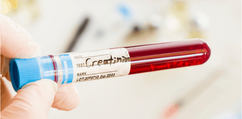 creatinine-and-kidney-disease