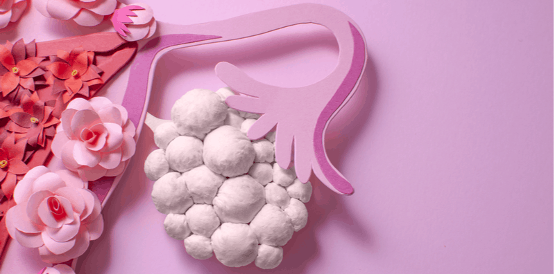polycystic-ovaries-syndrome-diagnosis-treatment