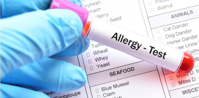 is-allergy-test-really-helpful