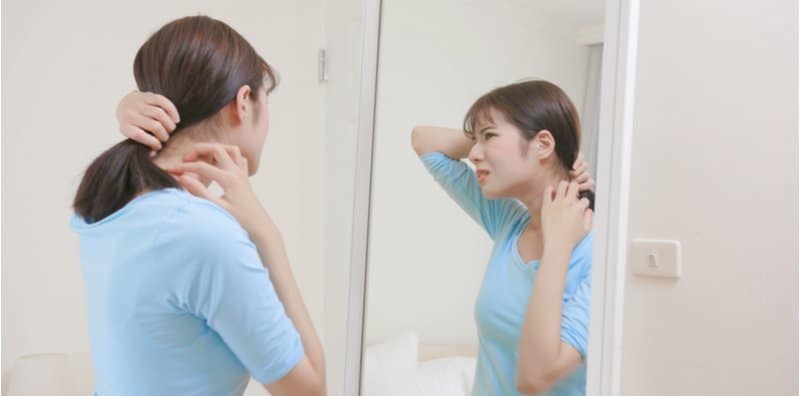 anxiety-can-be-caused-by-chronic-spontaneous-urticaria