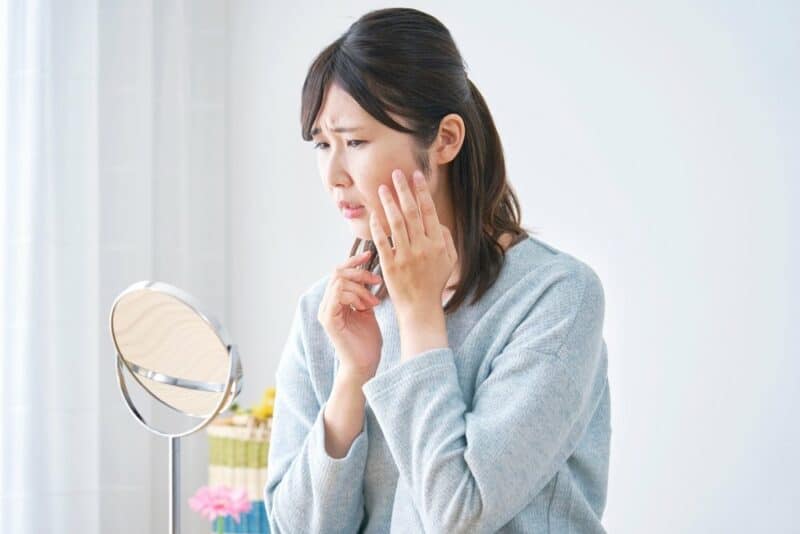 what-is-seborrheic-keratosis