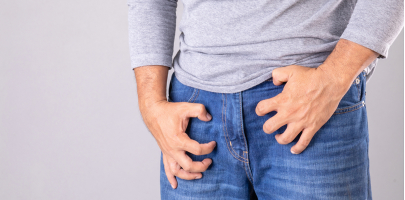 how-to-treat-tinea-cruris-and-its-symptoms